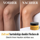🔥 Sommer-Sale 2026 – 50% sparen! 💞 Bereits über 70.000 mal verkauft. Kurkuma-Peeling für den Körper